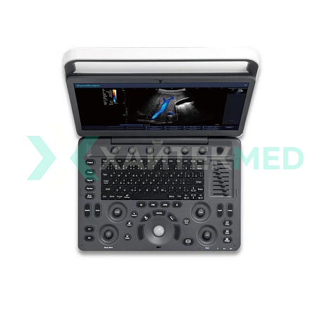 Портативный ультразвуковой сканер SonoScape E2 от «ХайтекМед»