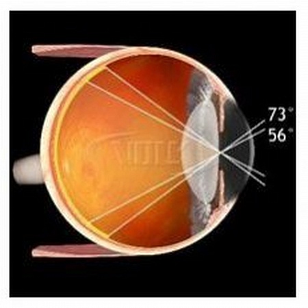 Линза Volk Pan Retinal® для непрямого офтальмоскопа (BIO) от «ХайтекМед»