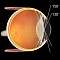 Хирургическая линза Volk HRX Vit Lens для непрямой офтальмоскопии от «ХайтекМед»