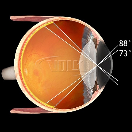Хирургическая линза Volk Central Retinal для непрямой офтальмоскопии от «ХайтекМед»