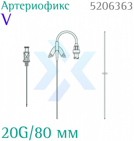 Набор артериальный Артериофикс V 20G/80 мм от «ХайтекМед»