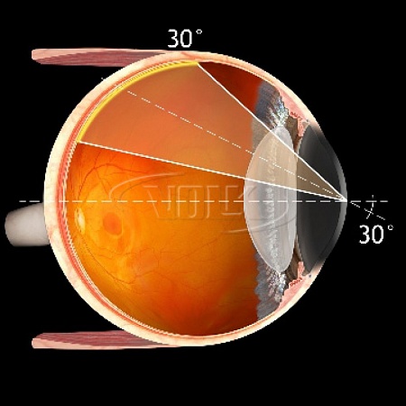 Хирургическая линза Volk Chalam 30° Prism SSV® (ASC) для прямой офтальмоскопии с опцией самостабилизации от «ХайтекМед»
