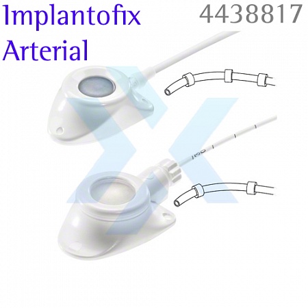Порт-система для артериального доступа Celsite Implantofix Arterial  от «ХайтекМед»
