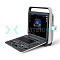 Портативный ультразвуковой сканер SonoScape S8Exp от «ХайтекМед»