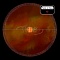 Хирургическая линза Volk Direct High Mag для прямой офтальмоскопии от «ХайтекМед»